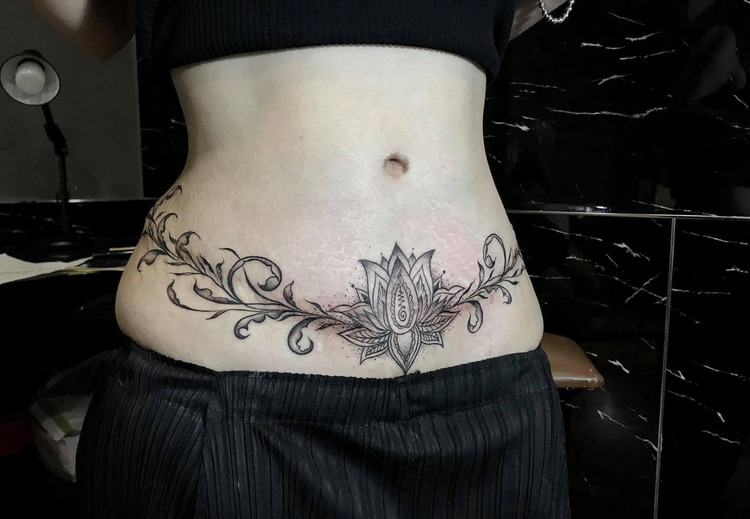 Tattoo che sẹo ở bụng
