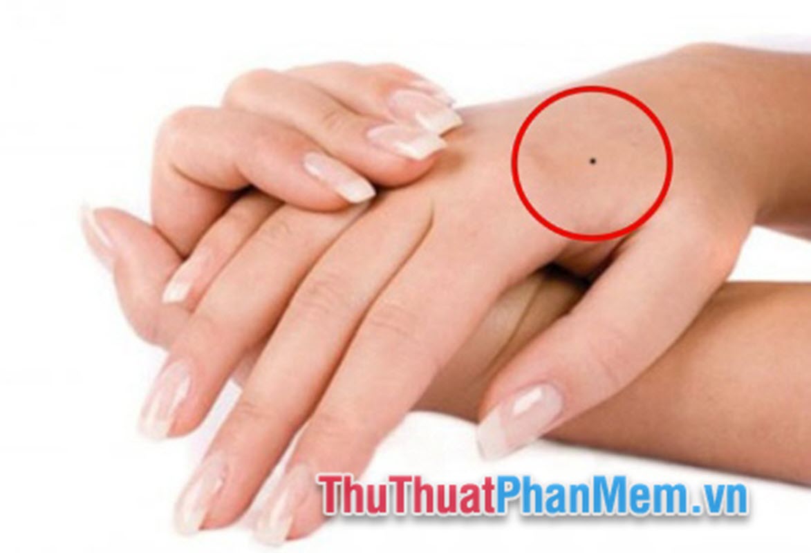 Nốt ruồi ở mu bàn tay phải