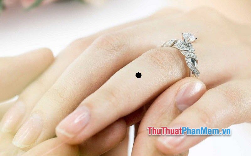 Nốt ruồi ở ngón tay áp út của nam và nữ