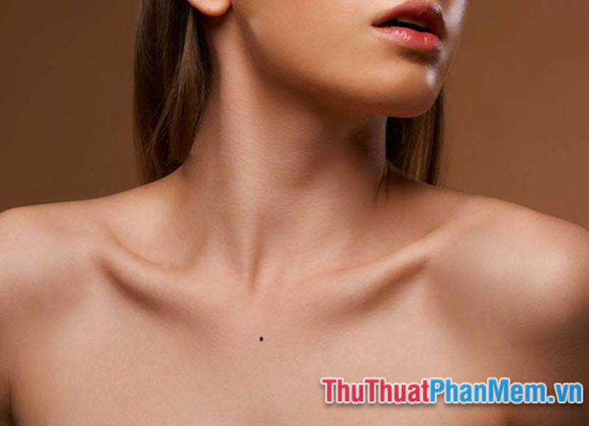 Nốt ruồi mọc ở vị trí trên ngực gần vực cổ và yết hầu