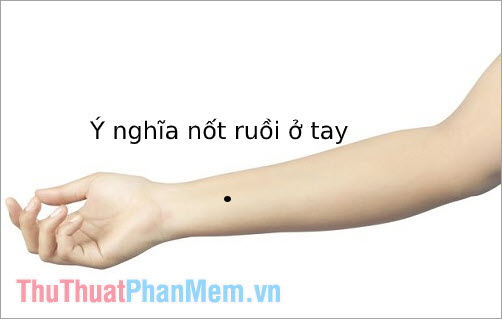 Ý nghĩa của những nốt ruồi trên cổ tay